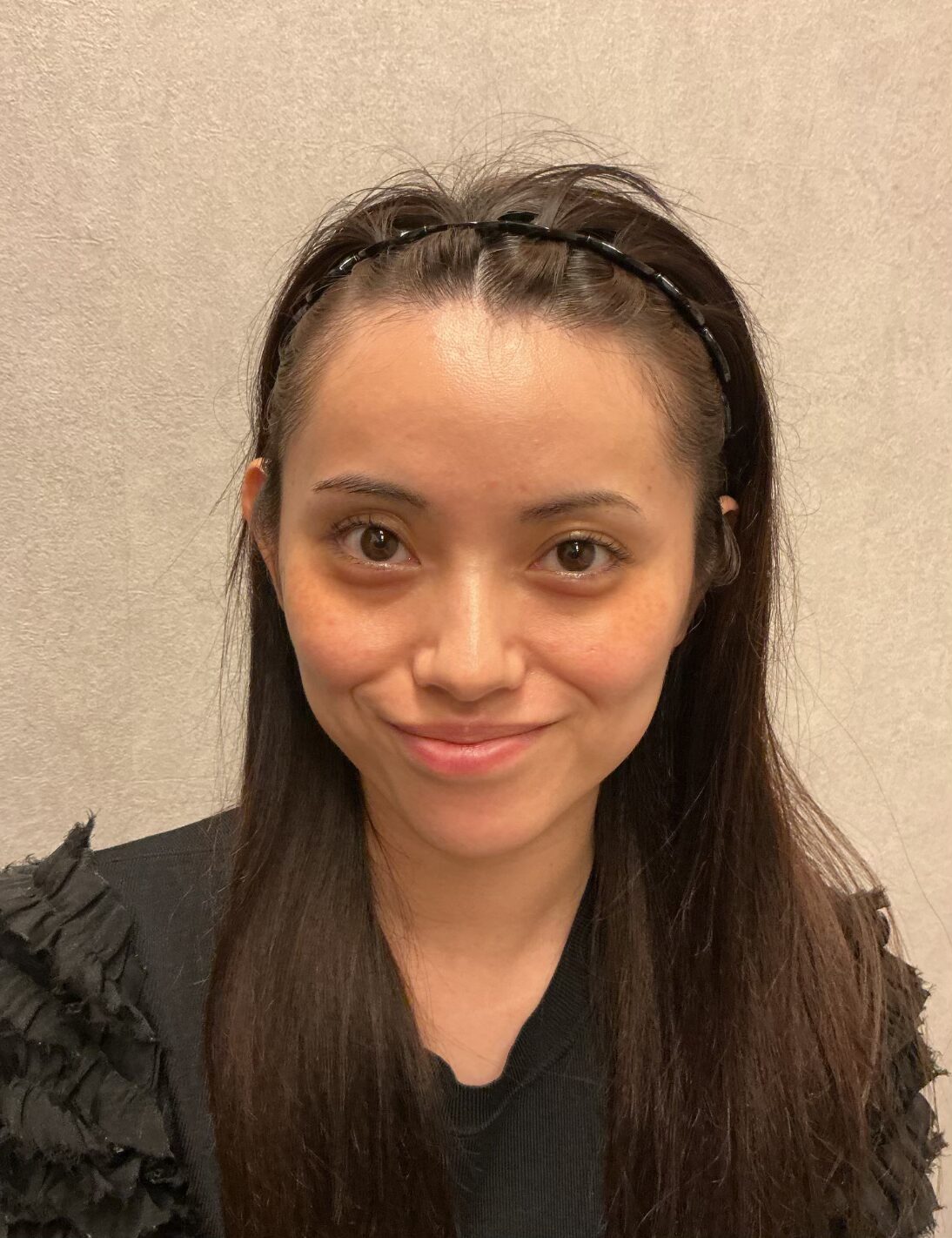 20代 女性 クマ・頬のこけ After