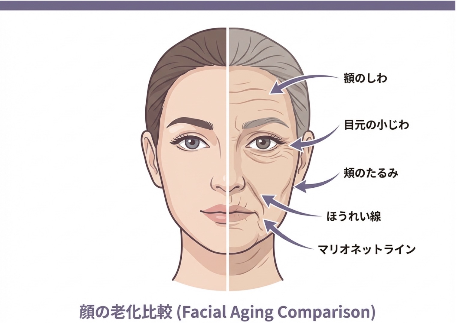 顔の老化の比較｜大阪 心斎橋BiBiクリニック
