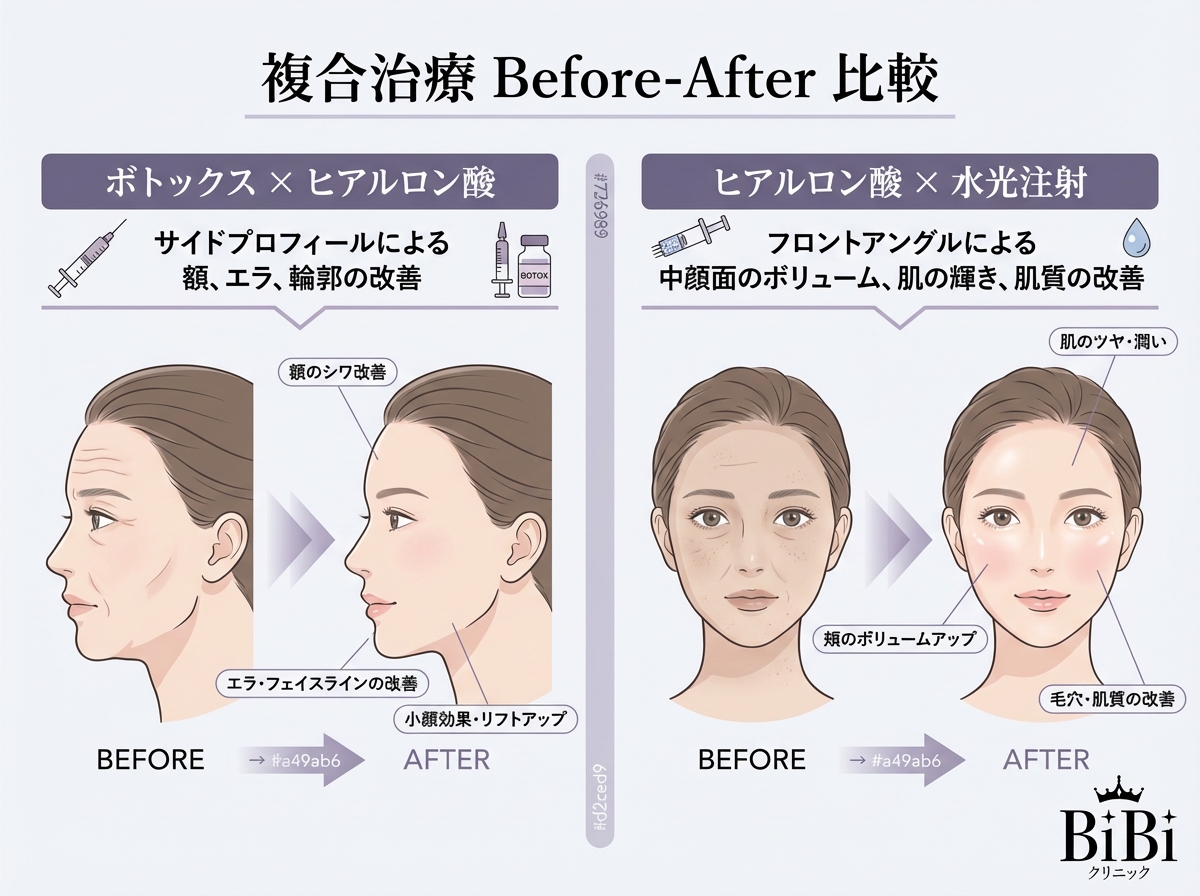 ボトックス×ヒアルロン酸・ヒアルロン酸×水光注射の症例比較｜大阪 心斎橋BiBiクリニック