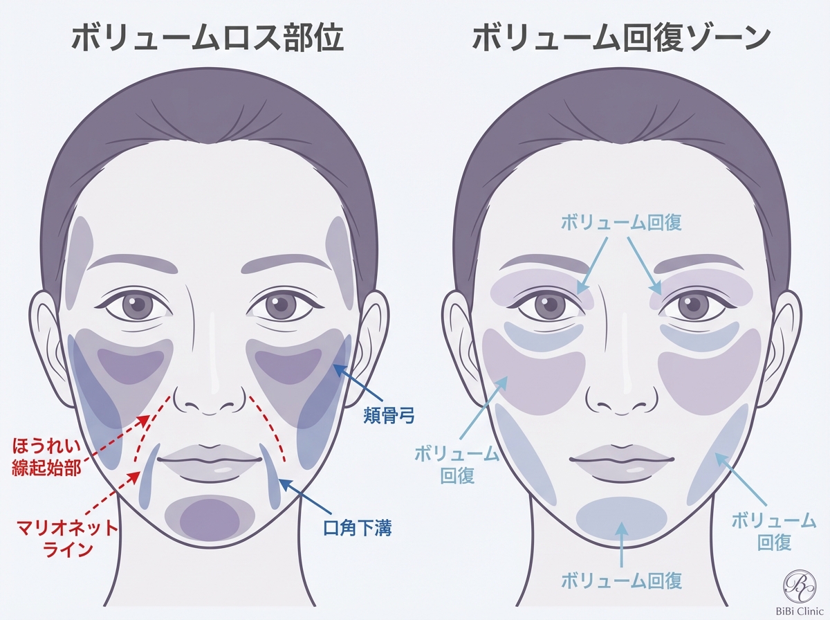 ヒアルロン酸症例写真で確認すべきポイント
