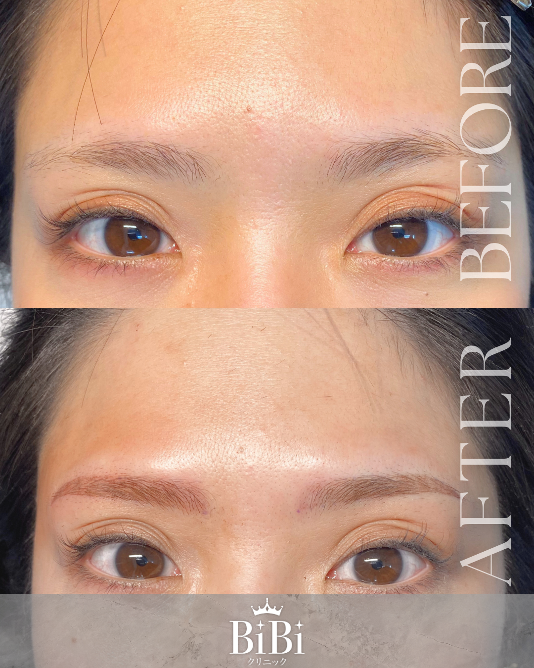 30代女性 眉アートメイク2D 正面 Before After