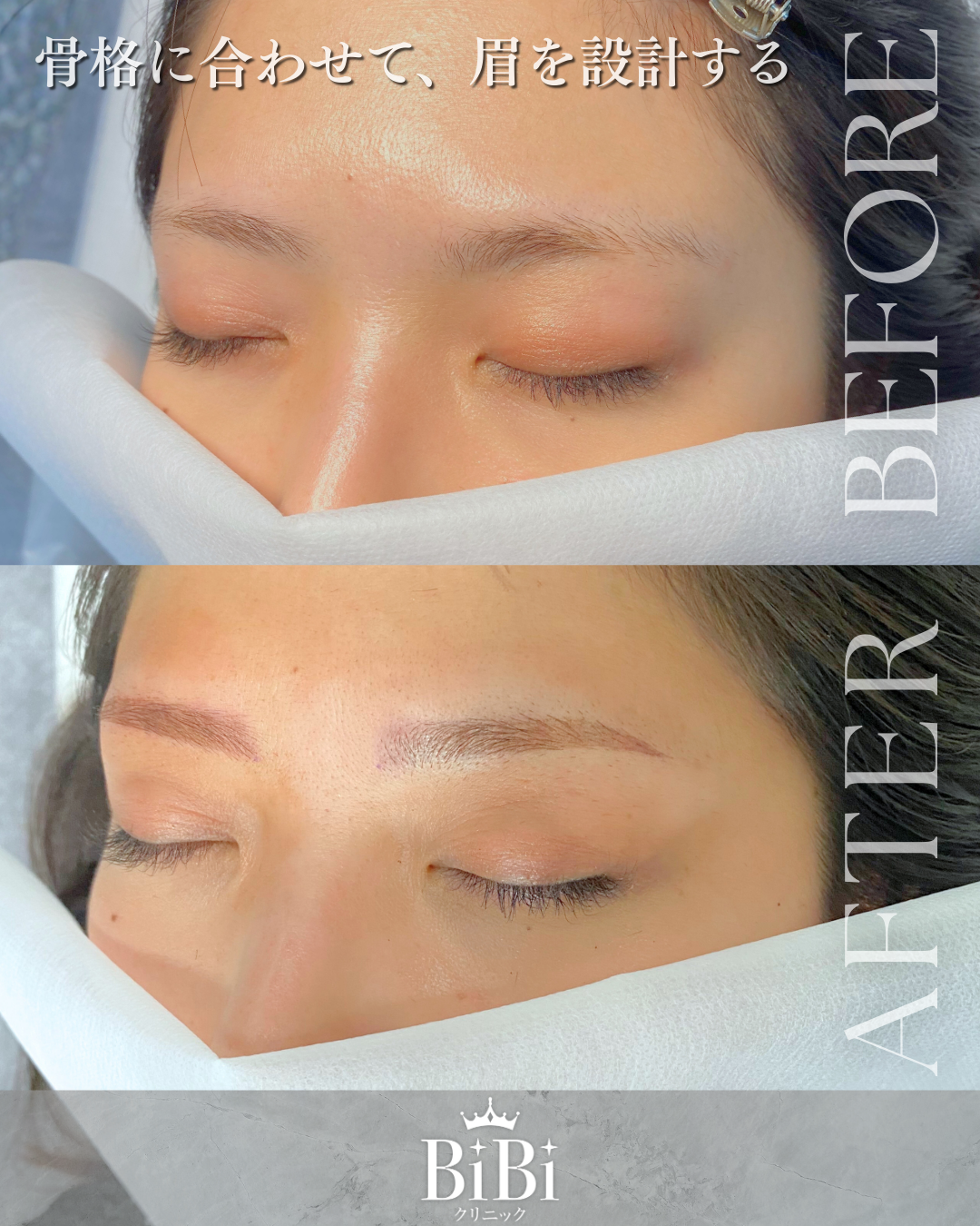 30代女性 眉アートメイク2D 左斜め45度 Before After