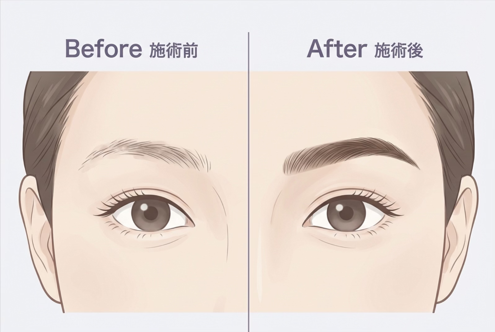 眉アートメイク｜眉の形と表情バランスを整えるデザイン｜大阪・心斎橋 BiBiクリニック