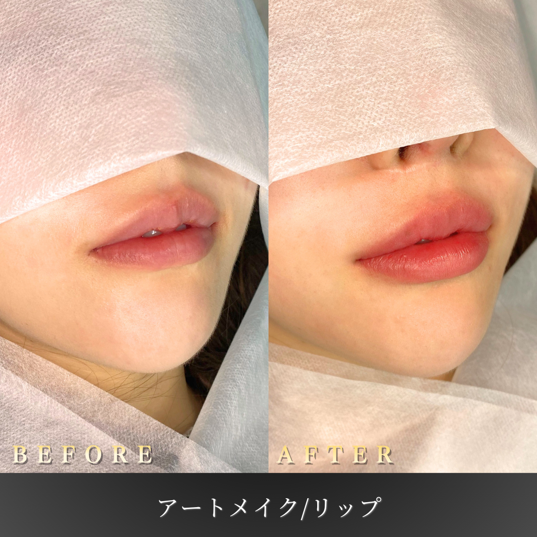 20代女性のリップアートメイク施術前後の正面45度写真