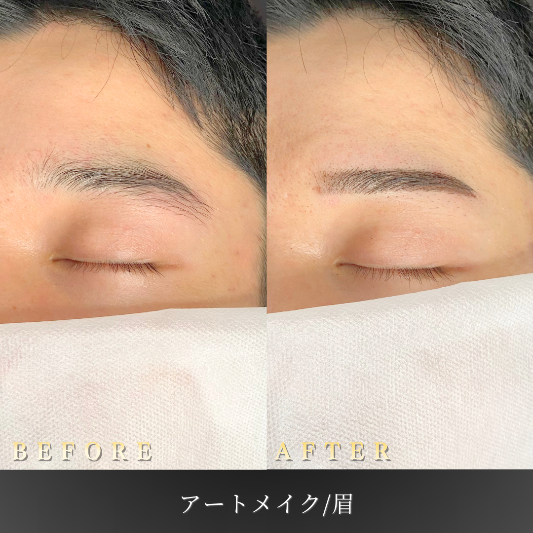 【20代男性】仕事でも浮かない眉アートメイク症例｜大阪 心斎橋BiBiクリニックの症例写真