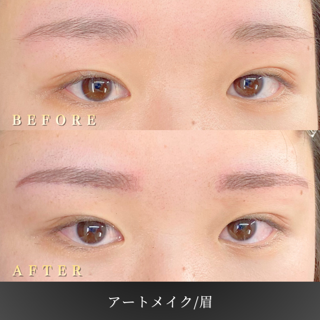 20代女性の眉アートメイク追加角度のBefore/After写真