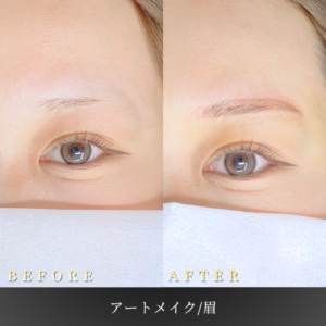 20代 眉アートメイク 症例写真〔正面Before/After〕｜大阪 心斎橋BiBiクリニック