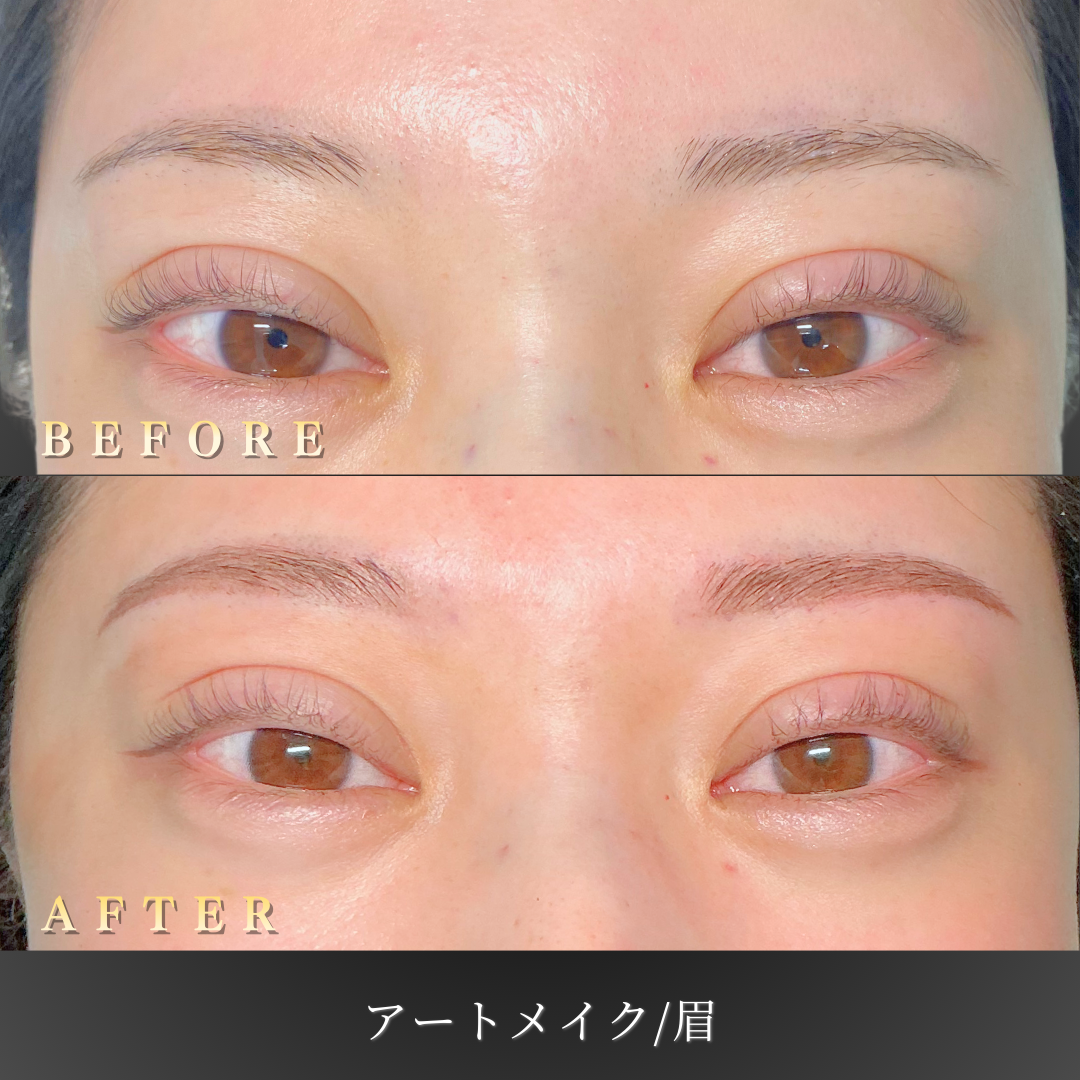 20代女性の眉アートメイク 右斜め45度 施術前後