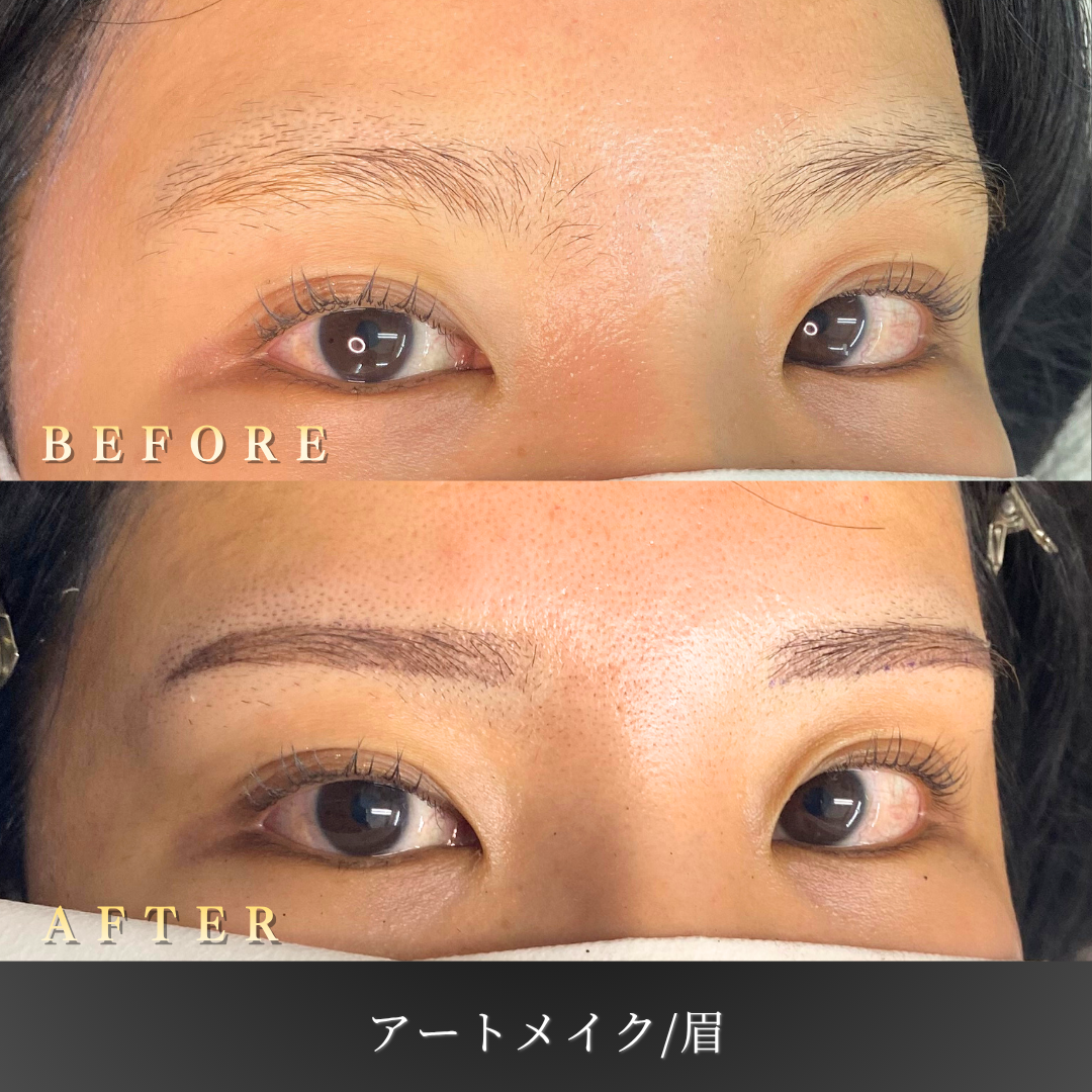 20代女性の眉アートメイク Before/After 左45度」 style=