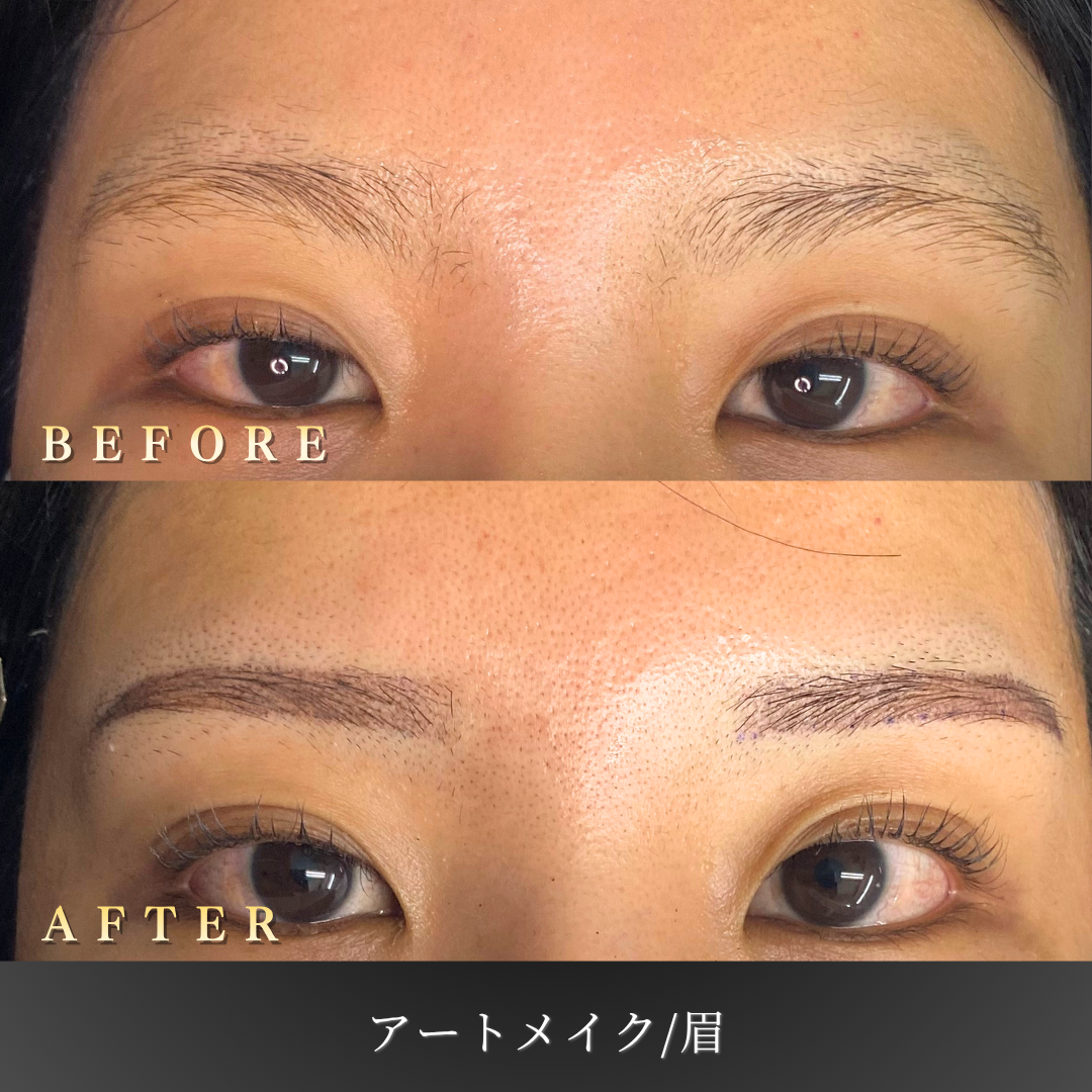 20代女性の眉アートメイク Before/After 正面」 style=