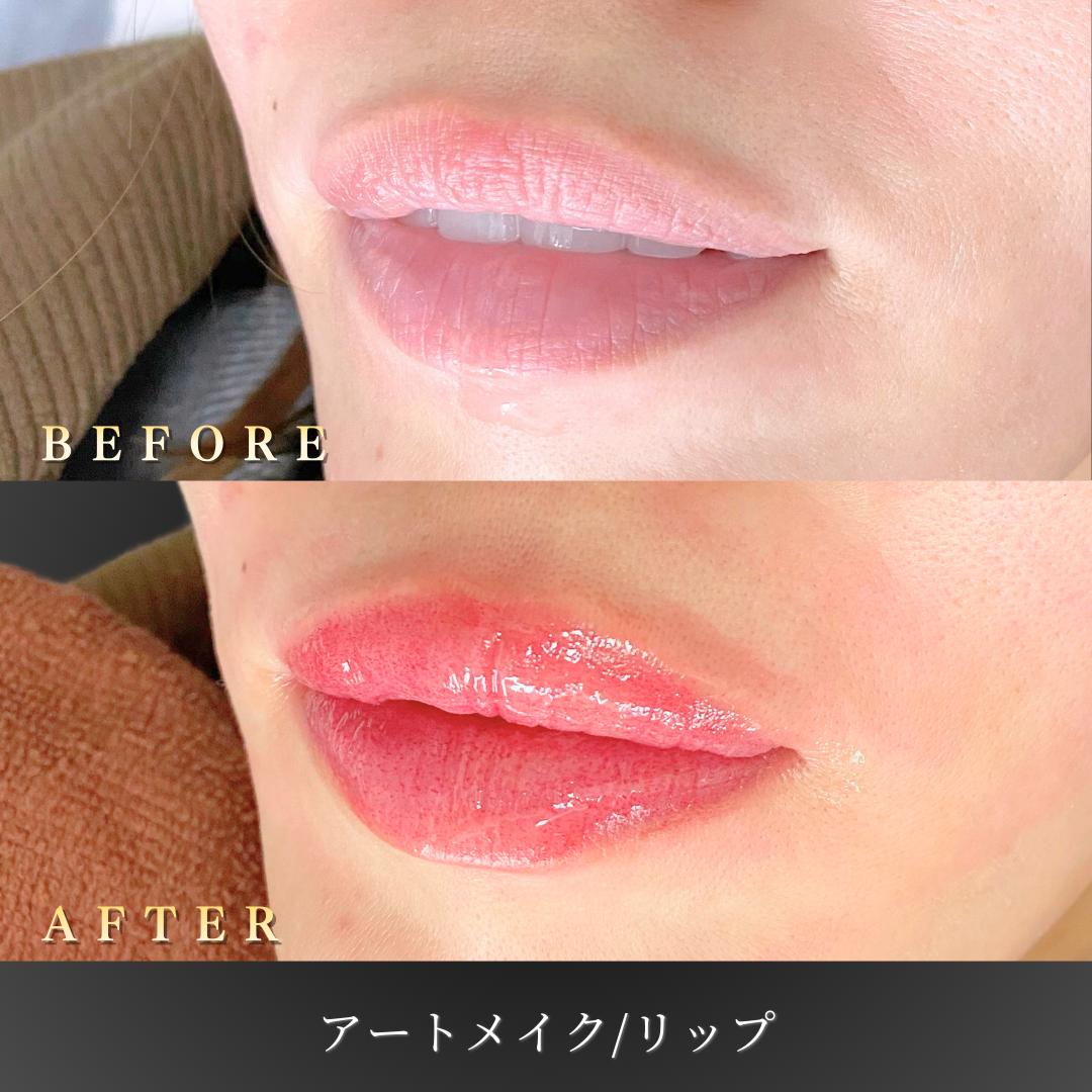 【30代女性】ぼやけた輪郭を整えるリップアートメイク症例｜大阪 心斎橋BiBiクリニックの症例写真