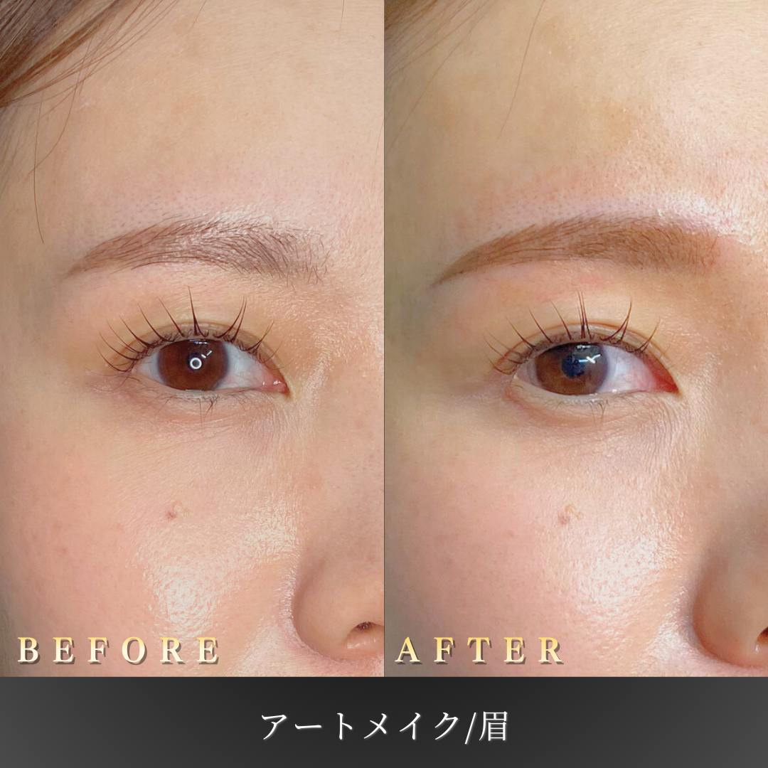 【30代女性】仕事でも浮かない眉アートメイク症例｜大阪 心斎橋BiBiクリニックの症例写真