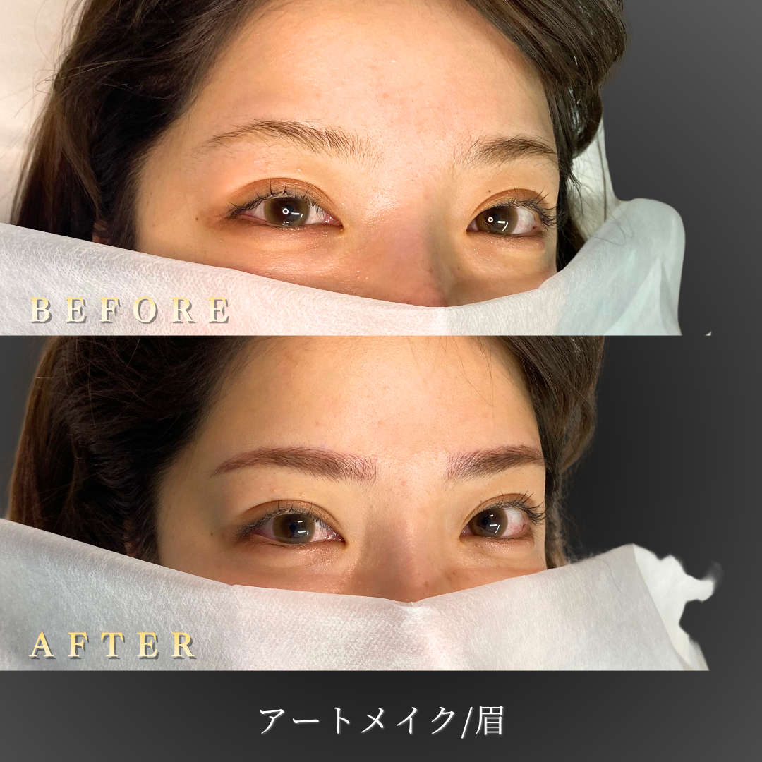 20代女性の眉アートメイク施術前後の右45度写真