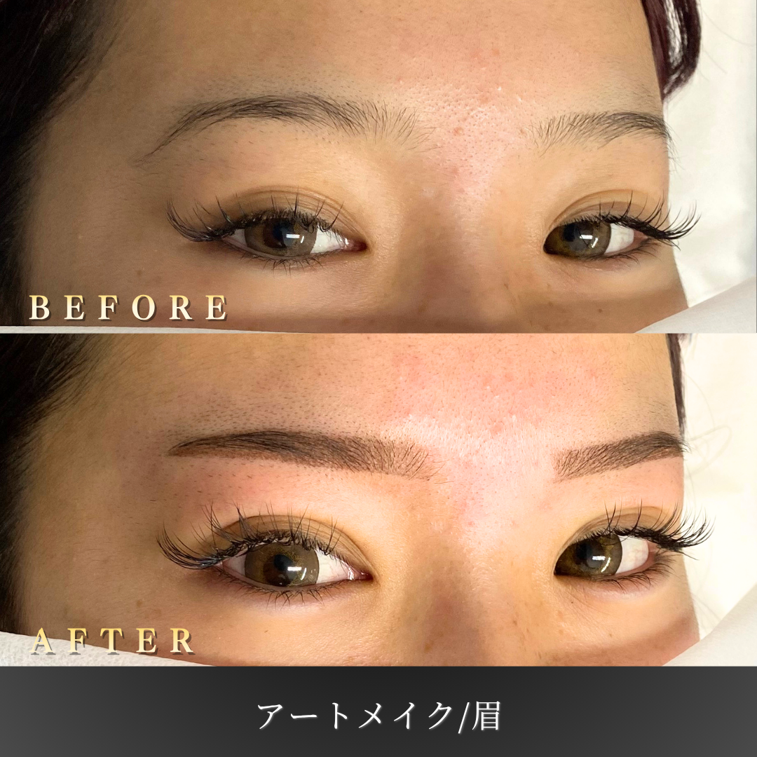 【20代女性】平行眉に整える眉アートメイク症例｜大阪 心斎橋BiBiクリニックの症例写真