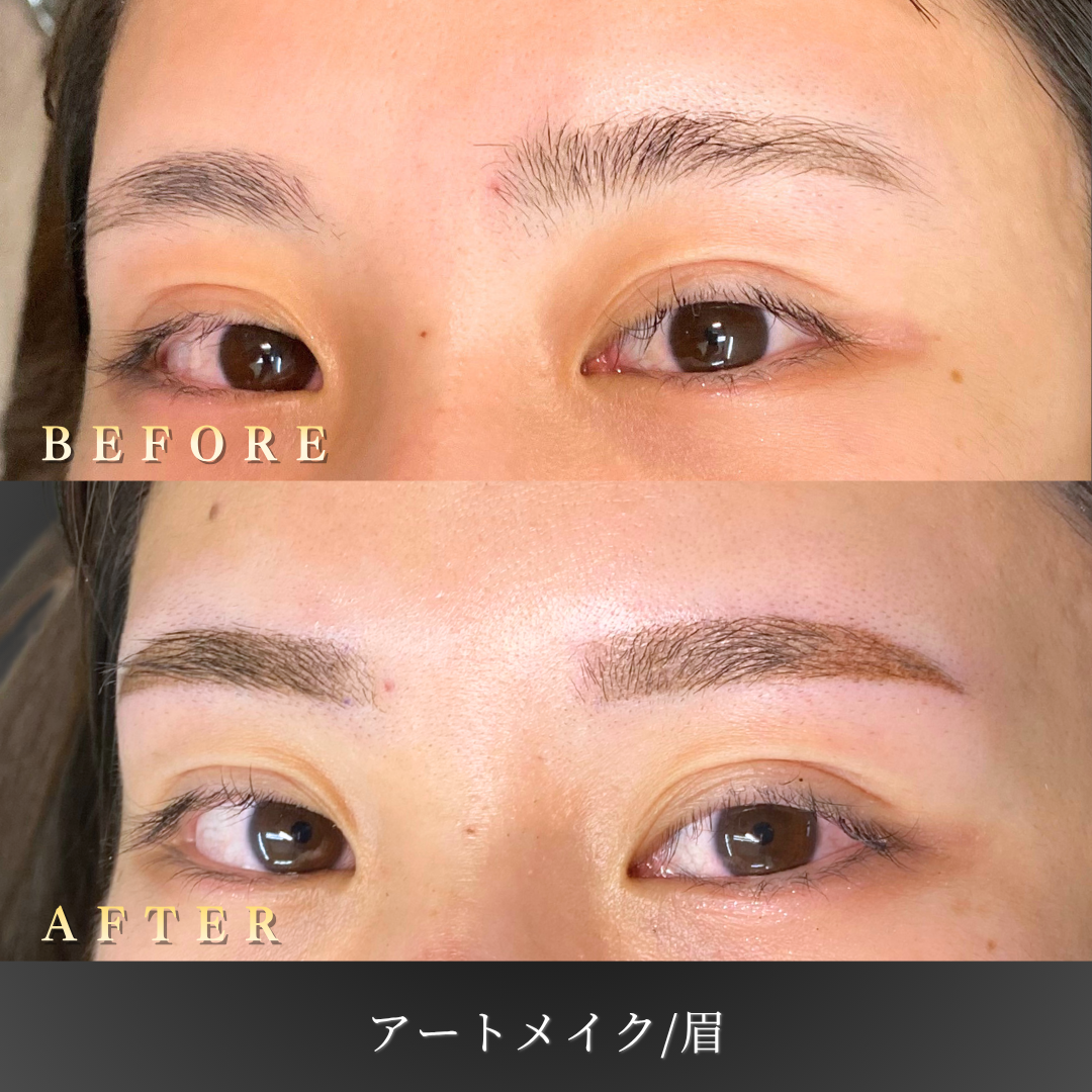 眉アートメイク施術前後の左45度写真比較