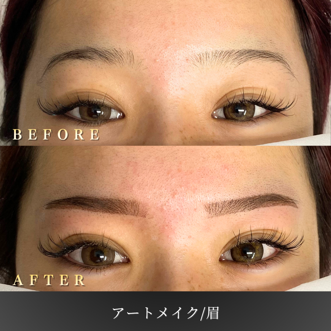 【20代女性】時短を叶える眉アートメイク症例｜大阪 心斎橋BiBiクリニックの症例写真