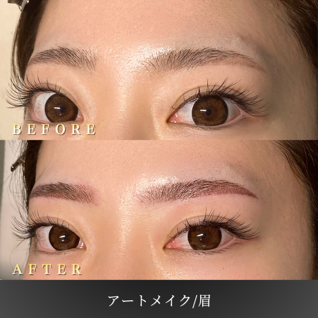 【30代女性】垢抜け眉に整える眉アートメイク症例｜大阪 心斎橋BiBiクリニックの症例写真