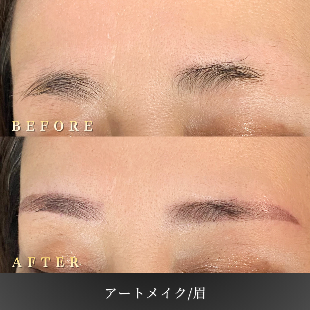 【50代女性】消えた眉を補う眉アートメイク症例｜大阪 心斎橋BiBiクリニックの症例写真