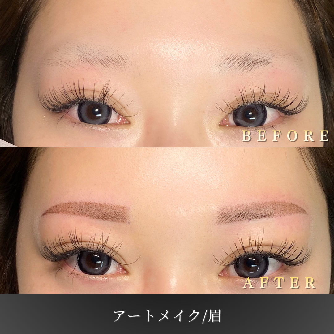 【20代女性】運動時も崩れにくい眉アートメイク症例｜大阪 心斎橋BiBiクリニックの症例写真