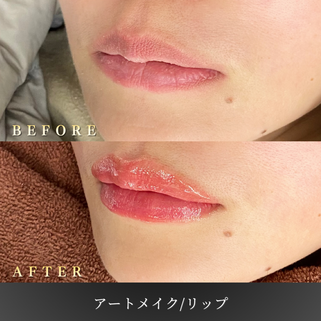 【40代女性】上品な血色に整えるリップアートメイク症例｜大阪 心斎橋BiBiクリニックの症例写真